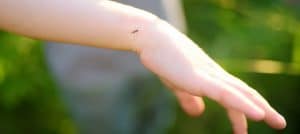 Childs hand with mosquito biting